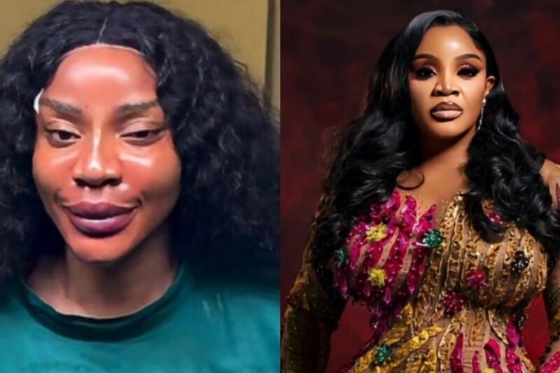 Uche Ogbodo Shows Off ‘New Face’ After Undergoing Cosmetic Procedures